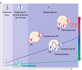 Настанова Європейського товариства кардіологів (ESC) 2019 року щодо діагностики й лікування хронічних коронарних синдромів: Короткий конспект у схемах і таблицях