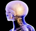 Терапия черепно-мозговой травмы с позиции доказательной медицины