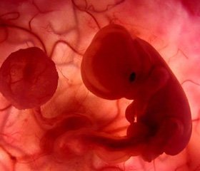Особенности объемного кровотока хориона  и допплерометрические характеристики кровотока  в маточных артериях у беременных с угрозой прерывания  в первом триместре на фоне гипопрогестеронемии