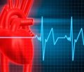 Инфаркт: новый анализ сокращает пребывание в больнице