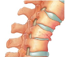 Клінічні аспекти біомеханіки травматичних ушкоджень шийного відділу хребта