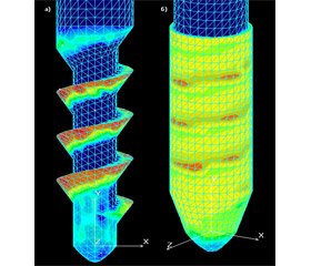 Comparative analysis of the stresses in the "bone-implant" system of the radial head arthroplasty with different design implants