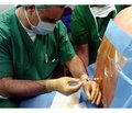 Effect of the volume preload on hemodynamic during spinal anesthesia for cesarean section