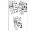 Open Injuries of the Spine and Spinal Cord