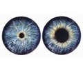 Pupillary diameter in brain death or clinical death: is it reliable?
