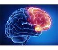 Мультимодальність фармакологічного захисту мозку як основа успішної терапії в ангіоневрології
