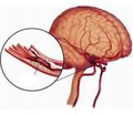 Роль біохімічних маркерів в патогенезі, діагностиці та прогнозуванні гострої церебральної ішемії