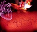 Довготривалий прогноз у жінок, які перенесли інфаркт міокарда