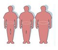 Особенности анестезиологического обеспечения при ожирении (Лекция I)